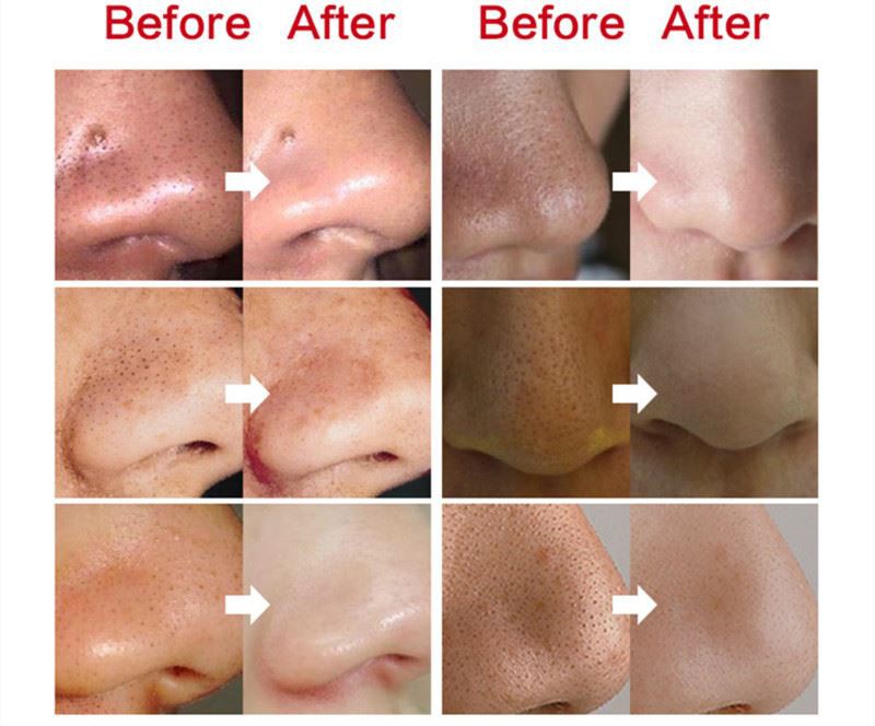 Product detailed5 Product detailed5