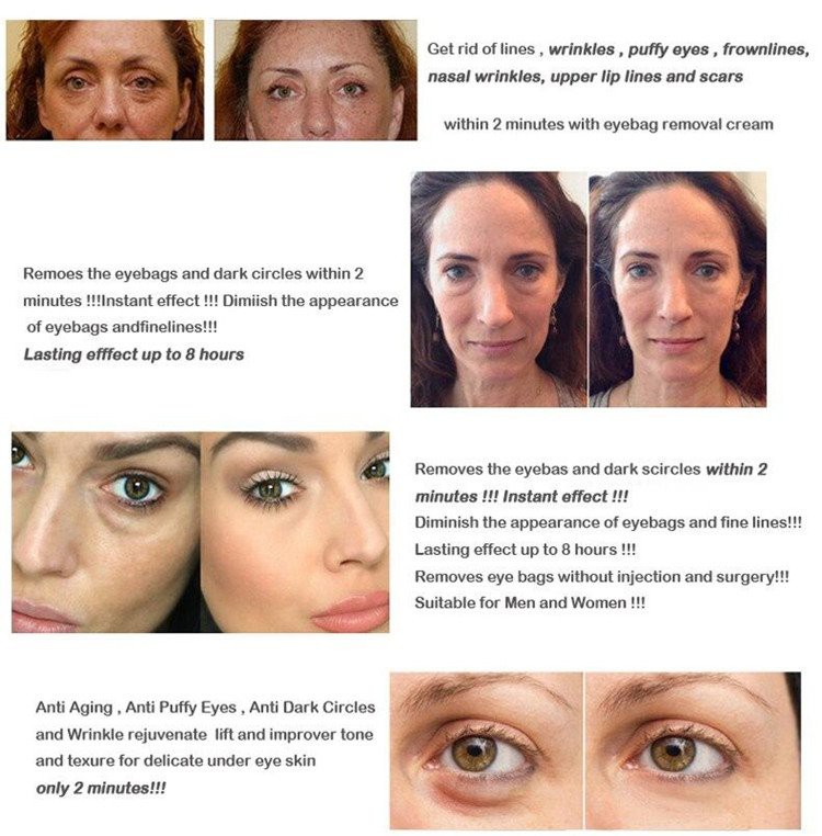 anti-aging eye cream anti-aging eye cream