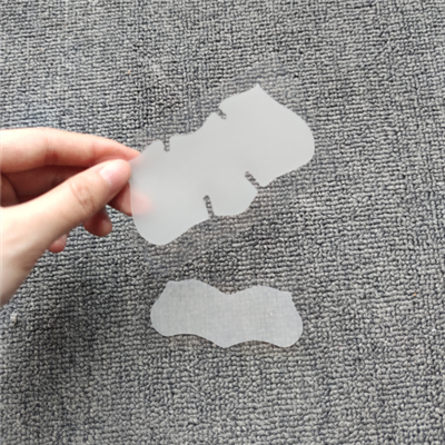 Stiallacha Srón a bhaint Blackhead